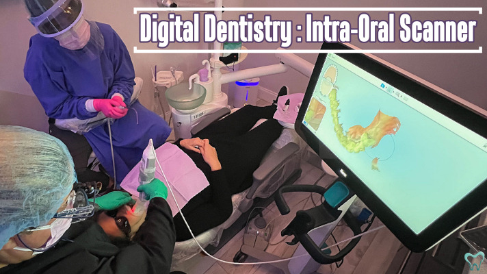 Digital Dentistry: Intra-Oral Scanner